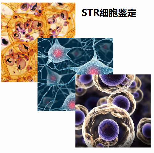 STR细胞鉴定
